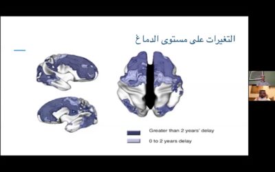 هل طفلي مصاب بفرط الحركة وتشتت الإنتباه؟